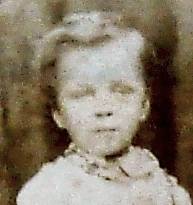 DicksonGeorgeFHAge3cm